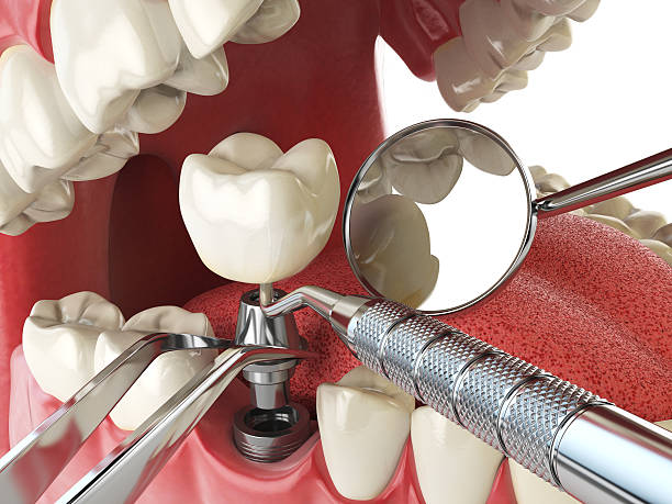 Best Emergency Pediatric Dental Care in Chevy Chase Village, MD